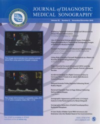 Journal of Diagnostic Medical Sonography Vol.32 Number 6 November/December 2016