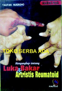 Mengungkap tentang Luka Bakar & Artristis Reumatoid
