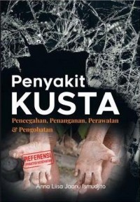 Penyakit Kusta Pencegahan, Penanganan, Perawatan, & Pengobatan